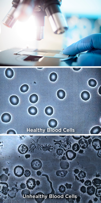 Live Blood Analysis Trugevity Health And Wellness
